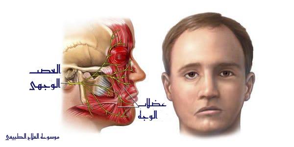 معلومات عن اللقوة أو ما يعرف بشلل العصب الوجهي